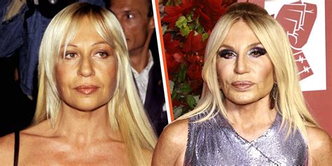 what happened to donatella versace|donatella versace without plastic surgery.